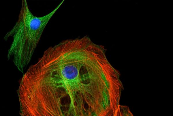 Custom annotation of public single-cell data offers opportunities for target identification