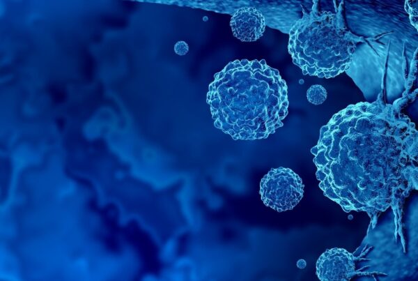 A Case Study On Optimizing Immunotherapy with Excelra’s AI-powered Patient Stratification