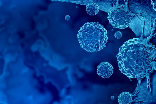 Optimizing Immunotherapy with Excelra's AI powered patient stratification