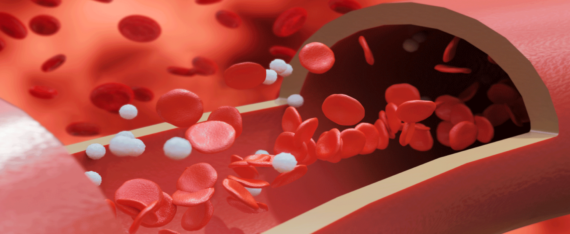Excelra rare monogenic disease banner image